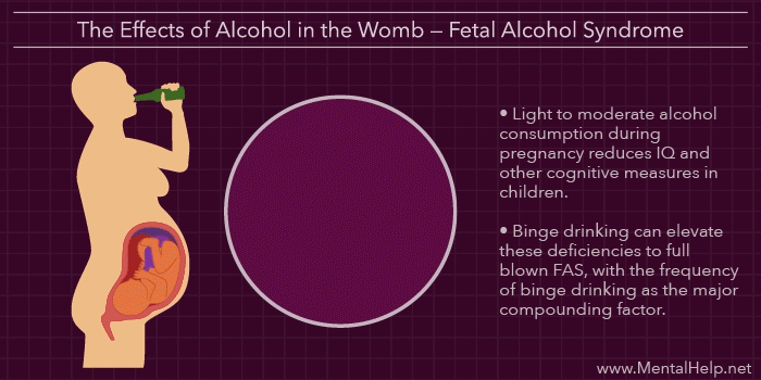 Fetal Alcohol Syndrome Cartoon