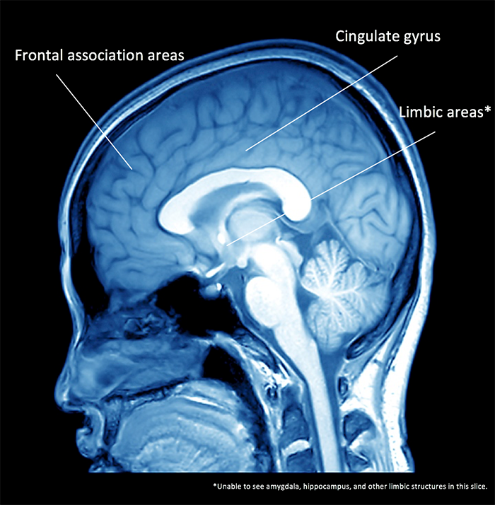 Limbic and frontal areas_MRI